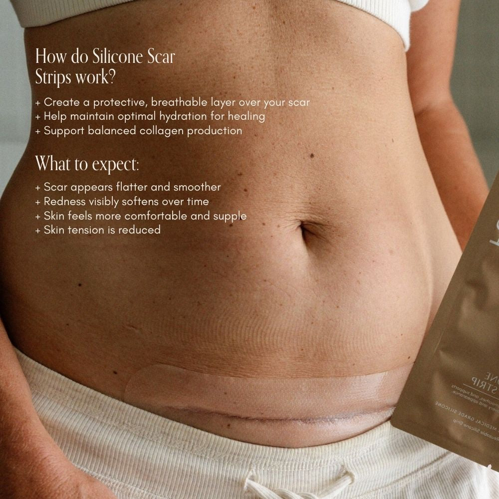 NEW C-Section Scar Care Kit