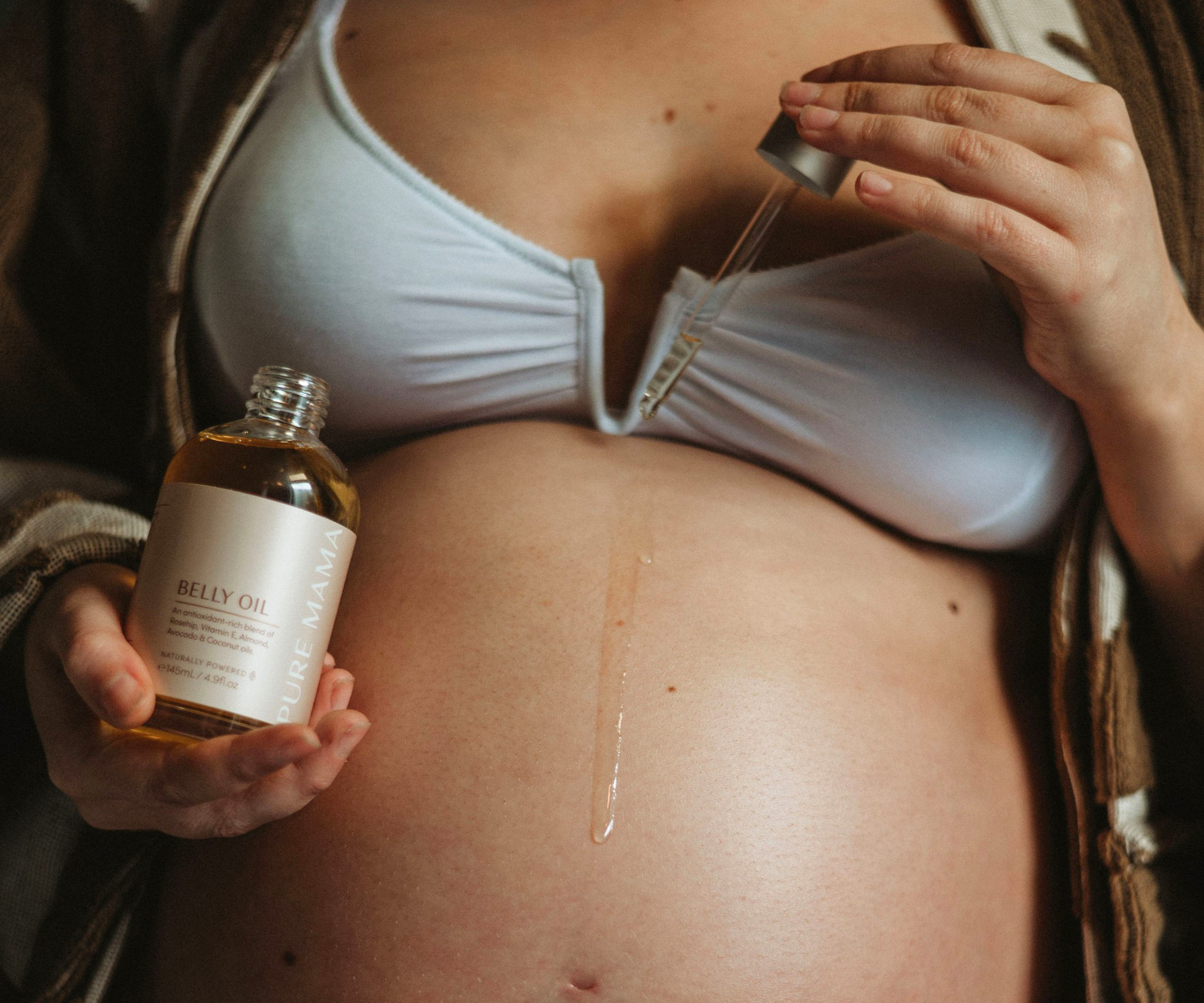 Stretch marks 101: Everything you need to know.