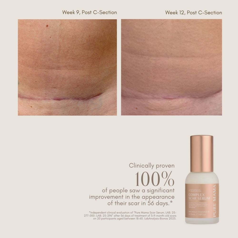 NEW Complex Scar Serum
