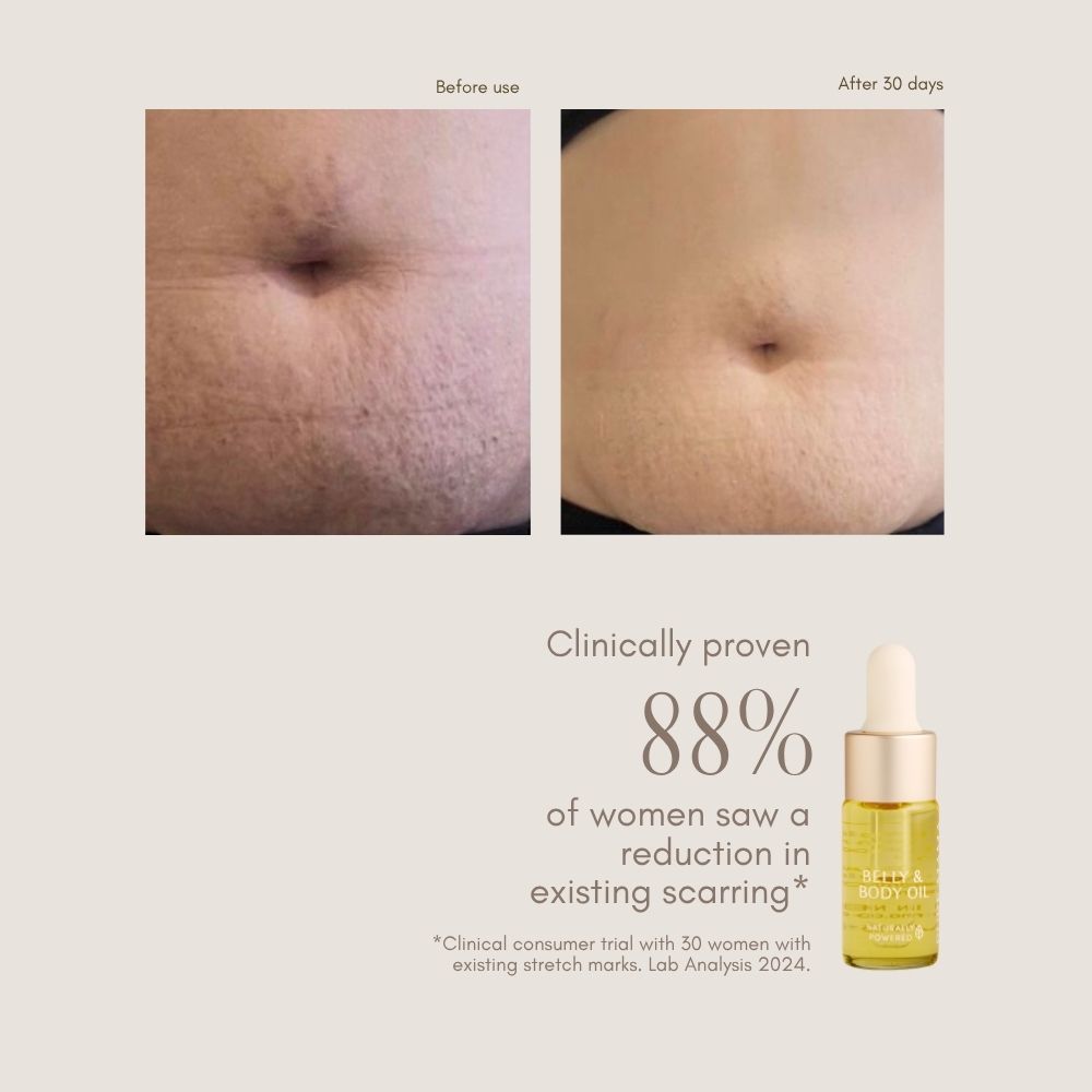 Belly & Body Oil Mini